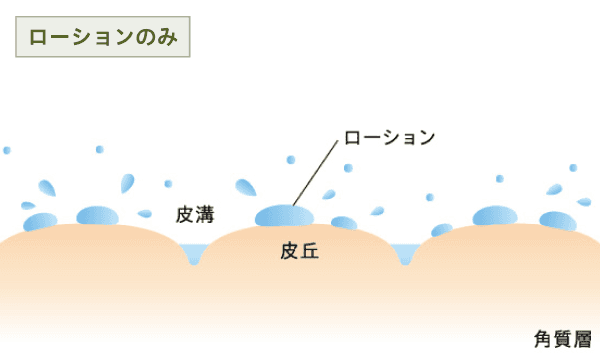 ローションのみ